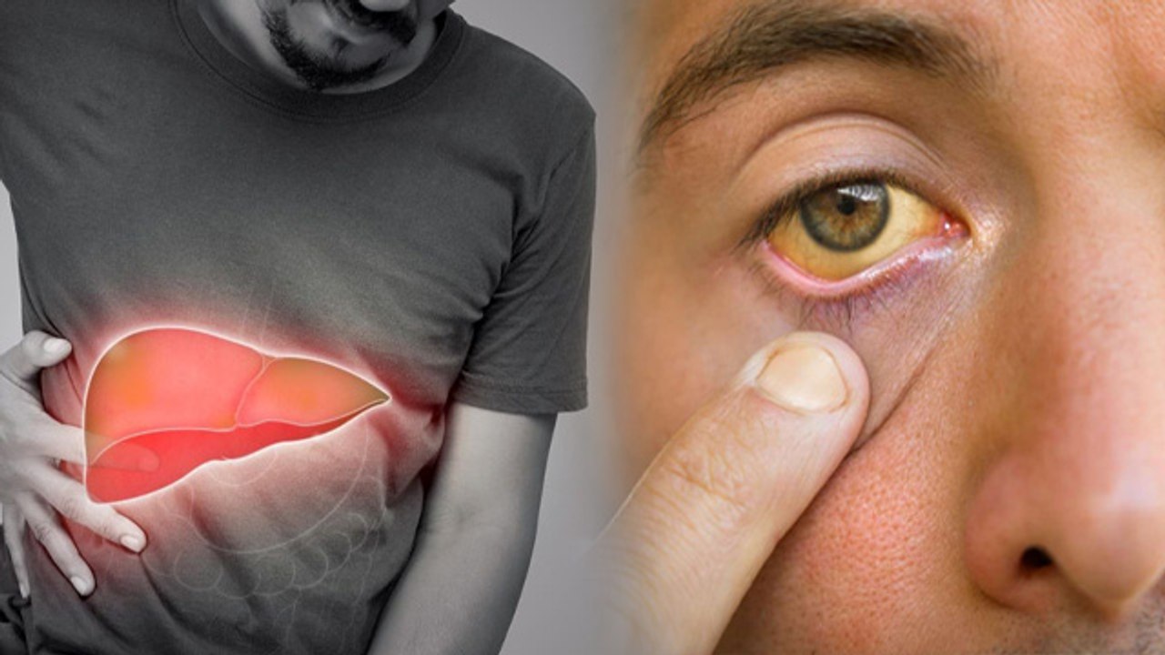 Liver Damage Signs In Eyes:लिवर खराब होने के लक...