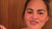 Chrissy Teigen verliert einen Zahn bei Weihnachtsmagie