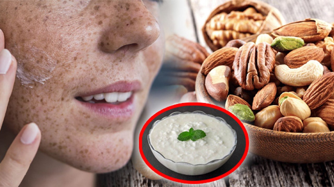 Blemishes On Face: चेहरे की झाइयां कैसे ठीक करे...