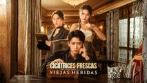 Cicatrices Frescas,Viejas Heridas