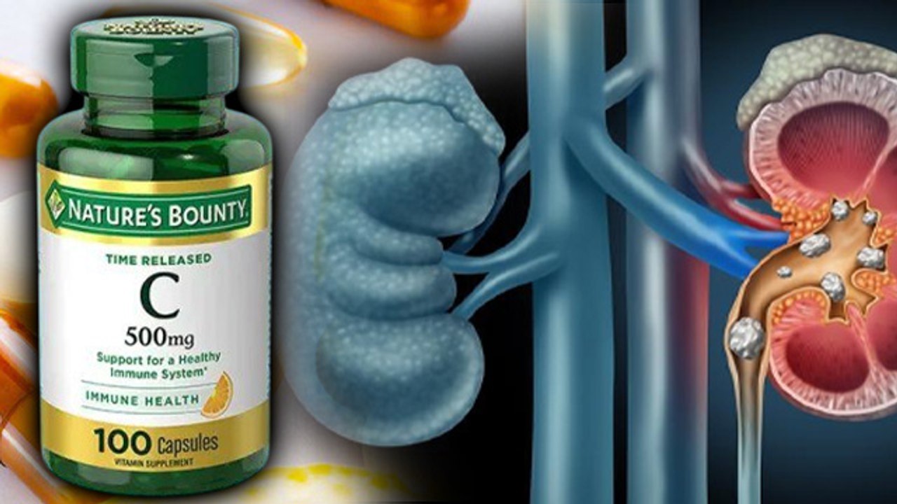 Vitamin C Tablet Causes Kidney Stones, क्या विटामिन सी टैबलेट खाने से पथरी होती है, Side Effects