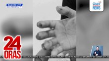 13-anyos, sugatan nang maputukan sa daliri ng napulot na plapla | 24 Oras
