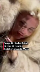 Pamje të rënda: Rrihet në mes të Tiranës Tiktokerja Suada Muca #kanalitre #suadamuca