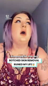 I was quoted $20,000 to fix my botched surgery 😱