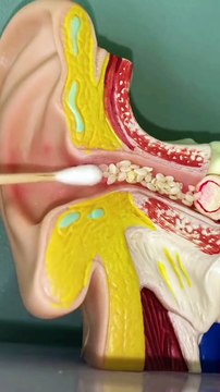 Your ears can be cleaned like this