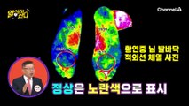 허리까지 발생한 관절염? 계속 방치하면 제거 수술까지 필요한 상황! 지금이라도 막을 수 있을까?