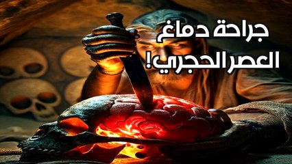 سر الثقوب الغامضة: كيف أجرى إنسان العصر الحجري عمليات جراحية في الدماغ؟