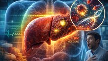 Liver Cancer Could Start Years Before Symptoms—Here’s How to Spot the Danger