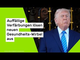 Donald Trump: Auffällige Verfärbungen lösen neuen Gesundheits-Wirbel aus