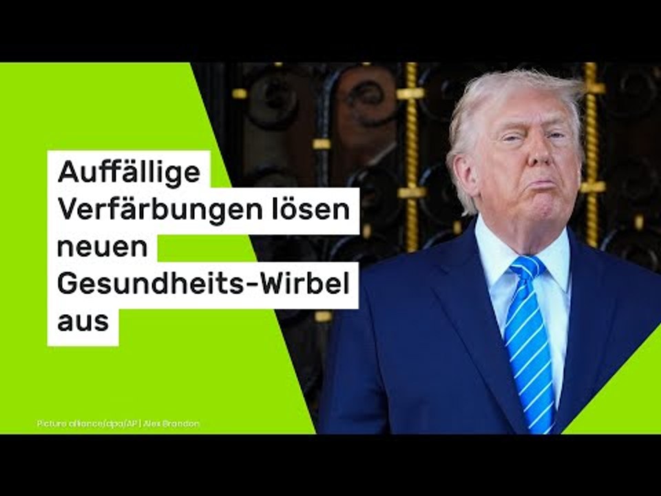 Donald Trump: Auffällige Verfärbungen lösen neuen Gesundheits-Wirbel aus