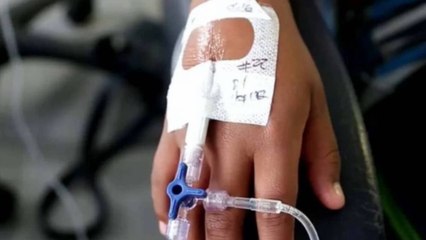 Alarmante cifra de quemados con pólvora: hay multas por uso irresponsable