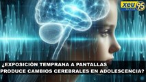 ¿Exposición temprana a pantallas produce cambios cerebrales en adolescencia?
