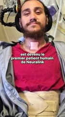🚨 En 2026, Neuralink veut massivement implanter des puces cérébrales sur l’humain