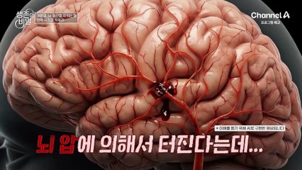 [예고] 뇌 속에 시한폭탄?! 겨울철 질병의 위협으로부터 생명을 지켜라!