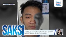 Lalaki, tinanggalan ng isang mata matapos masabugan ng paputok; 2 bata, pinutulan ng apat na daliri | Saksi