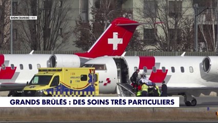 Grands brûlés : des soins très particuliers