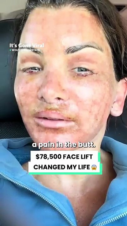 I'm reclaiming my beauty after my toxic ex... 💔