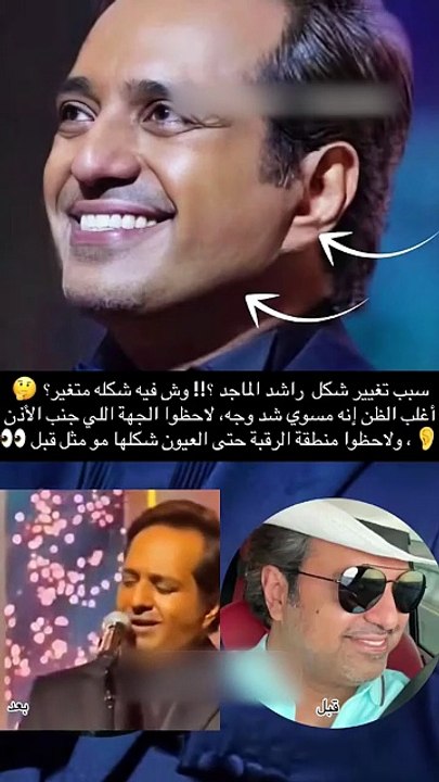 الكشف عن سبب تغير ملامح راشد الماجد كليا ونظرات...