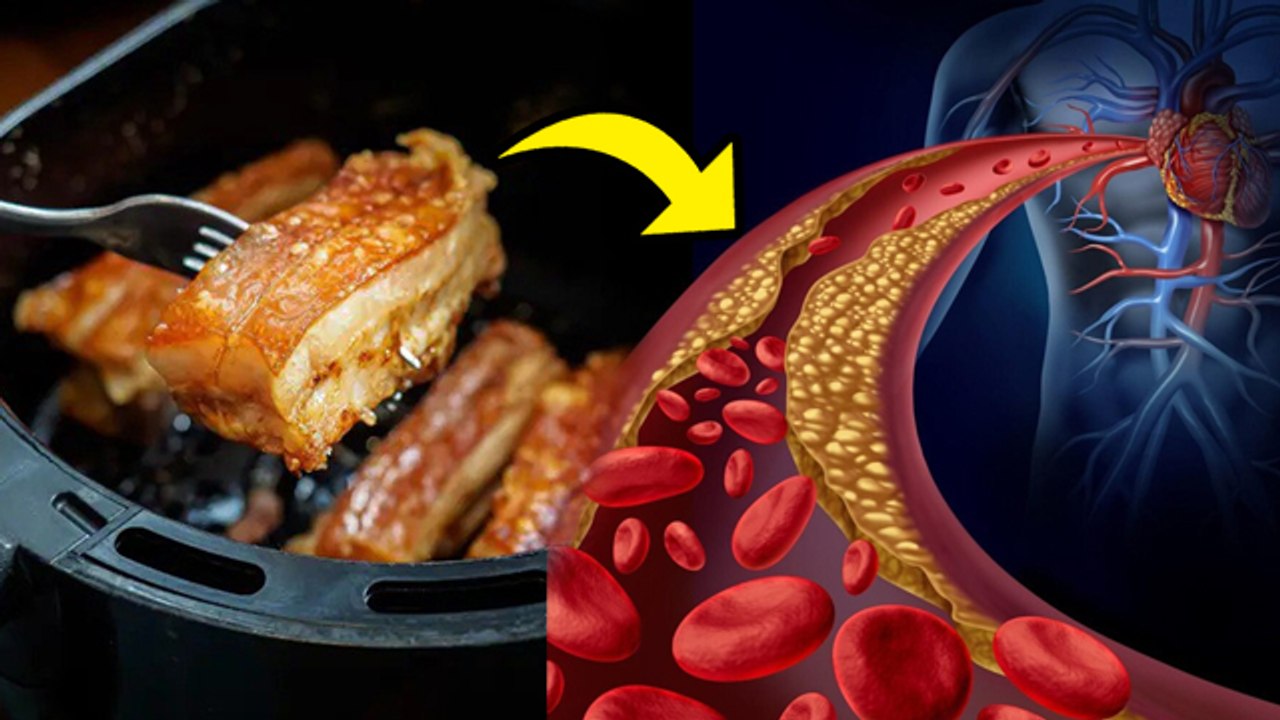 Air Fried Food Khane Se Cholesterol Badhta Hai, हाई कोलेस्ट्रॉल में क्या नहीं खाना चाहिए...|Boldsky