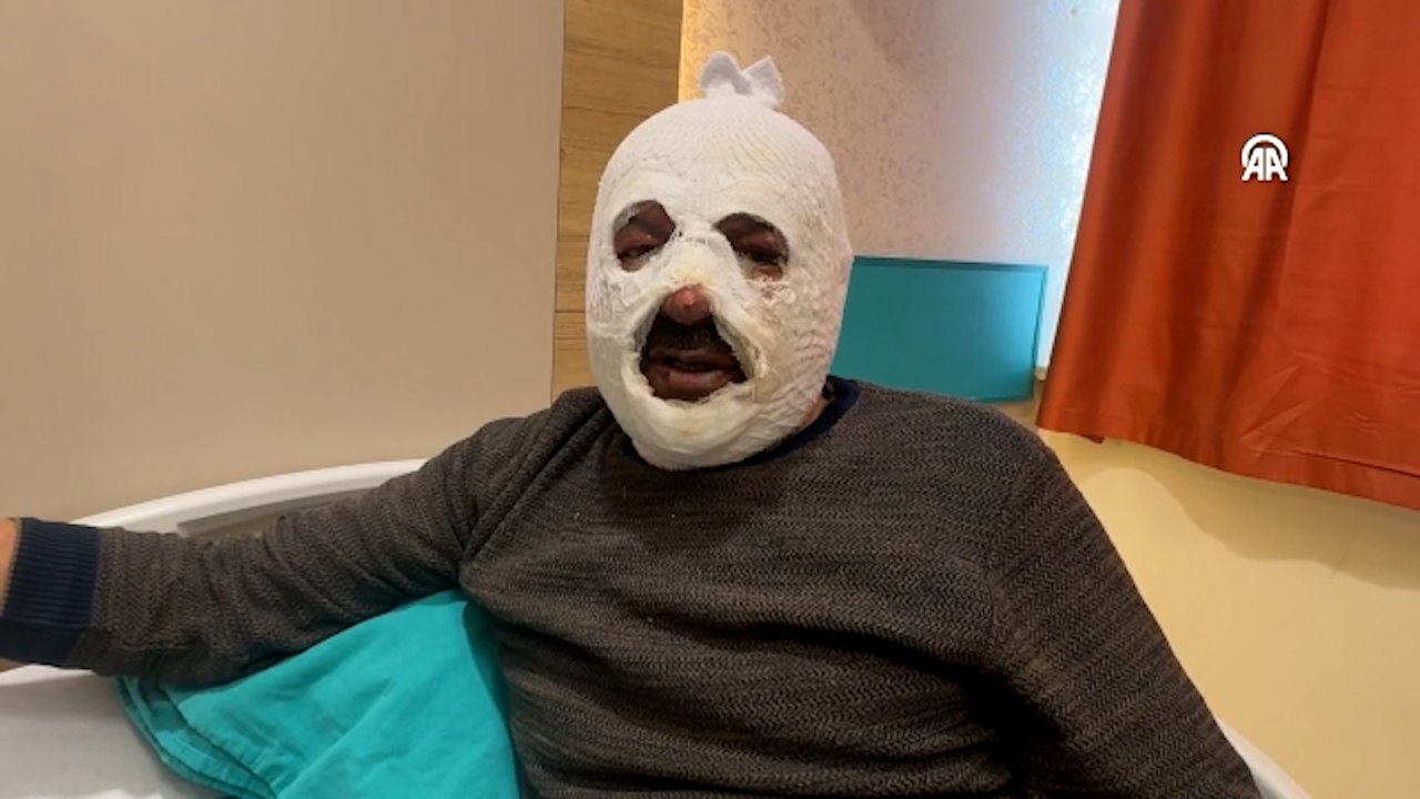 Kalorifer kazanını yakmak istedi canını zor kurtardı