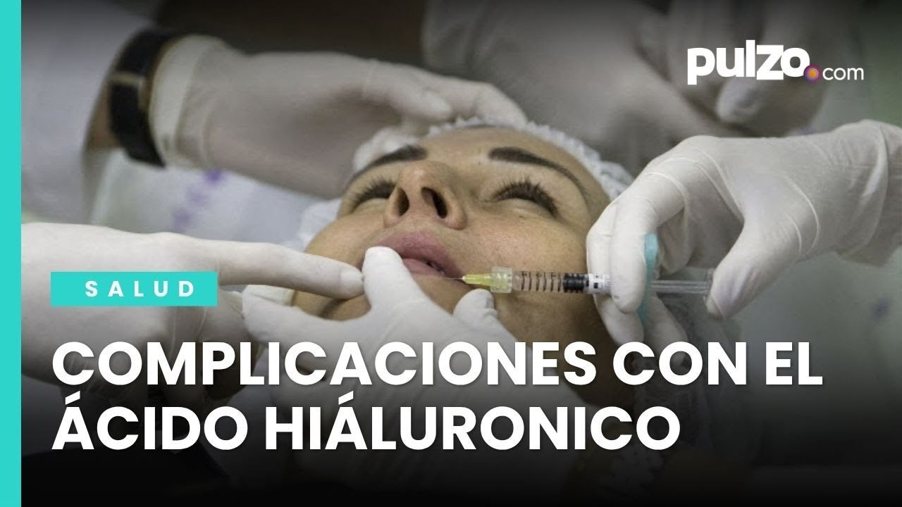 Masculinización facial y complicaciones con el ácido hiáluronico - Dr. Daniel Diaz Torrado.