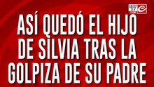 Así quedó el hijo de Silvia tras la golpiza de su padre