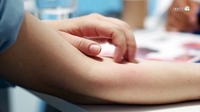 Bajo estudio, segunda muerte por sarampión en Jalisco