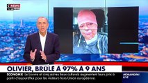 Olivier, brûlé à 97% à l’âge de 9 ans, témoigne dans « Morandini Live » sur CNews