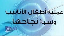 عملية أطفال الأنابيب بالتفصيل ونسبة نجاحها