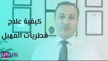 كيفية علاج فطريات المهبل