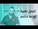أنواع تقنيات زراعة الشعر