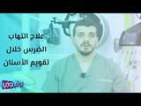علاج التهاب الضرس خلال تقويم الأسنان