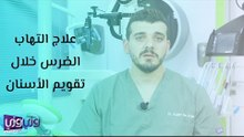 علاج التهاب الضرس خلال تقويم الأسنان