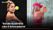 Tenista mexicana expõe queimaduras de sol após torneio na Austrália