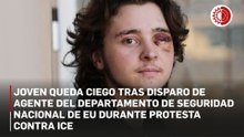 Joven manifestante pierde un ojo tras disparo de un policia en Santa Ana, California