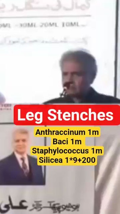 Leg steches and it's Treatment Dr Ali Muhammad