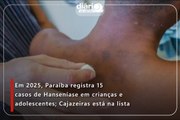 Em 2025, Paraíba registra 15 casos de Hanseníase em crianças e adolescentes; Cajazeiras está na lista
