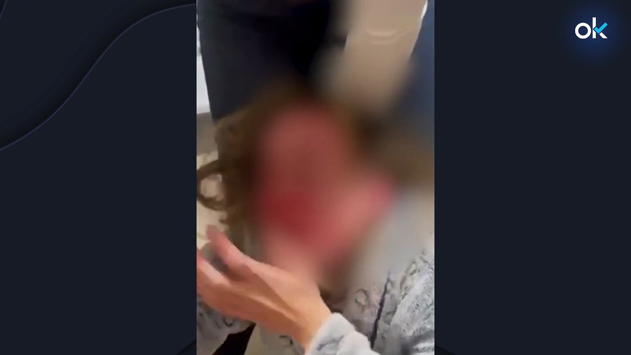 Dos mujeres secuestran y propinan una brutal paliza a otra por una supuesta infidelidad en Madrid