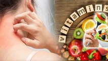 Kis Vitamin Ki Vajah Se Khujli Hoti Hai, Skin Itching Problem Solution, Vitamin Deficiency...