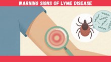 Lyme Disease: 7 Hidden Signs Your Doctor Might Overlook