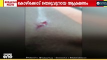കോഴിക്കോട് അരീക്കാട് വിദ്യാർഥിക്ക് നേരെ തെരുവുനായയുടെ ആക്രമണം