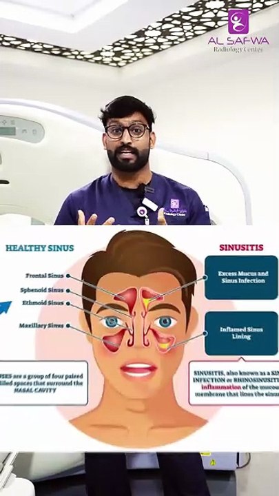 Is it just a cold, or is it Sinusitis