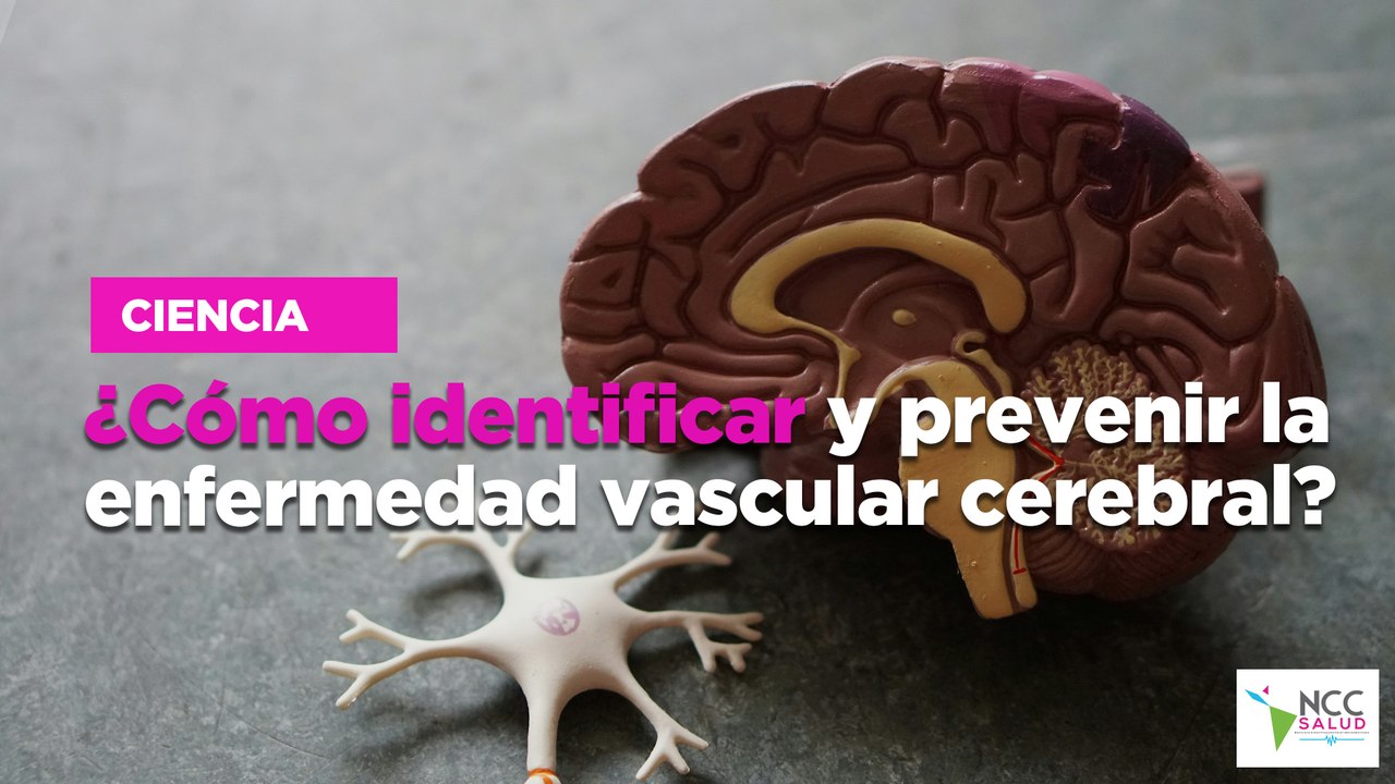 ¿Cómo identificar y prevenir la enfermedad vascular cerebral?