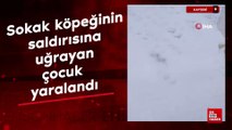 Kayseri’de sokak köpeğinin saldırısına uğrayan çocuk yaralandı