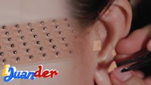 ‘Ear seeding’ para sa body pain?! | I Juander