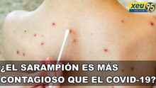 ¿El sarampión es más contagioso que el COVID-19?