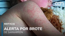 Brote de sarampión se dispara en México: autoridades refuerzan vacunación demasiado tarde