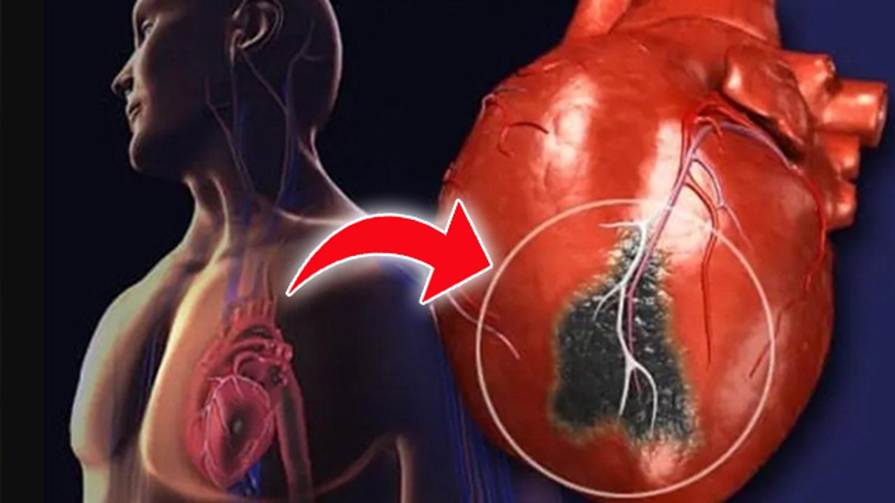 Arrhythmia vs Dysrhythmia: Difference,Meaning,Symptoms,Causes & Treatment |Boldsky