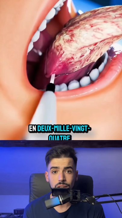 Il a perdu 90%