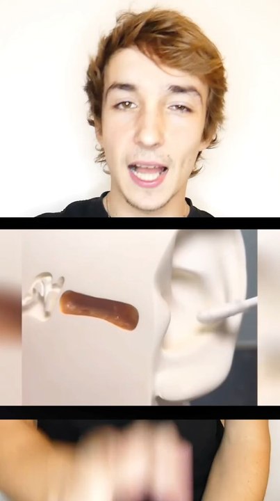 Arrête
